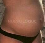 NuevoLoquo1