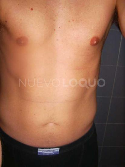 NuevoLoquo1