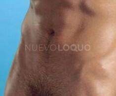 NuevoLoquo5