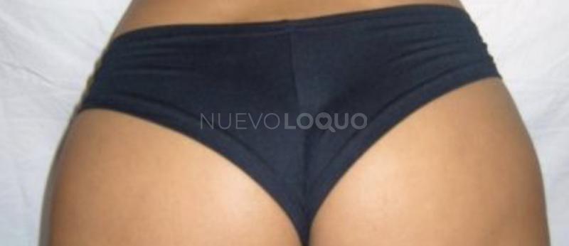 NuevoLoquo0