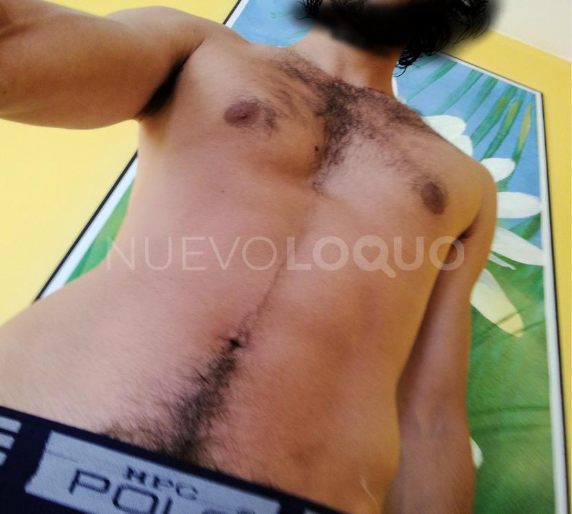 NuevoLoquo1