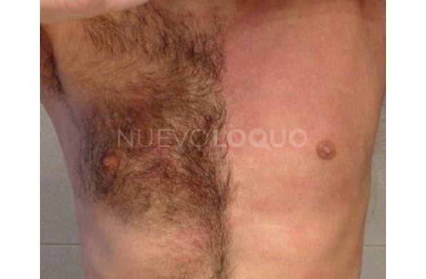NuevoLoquo1