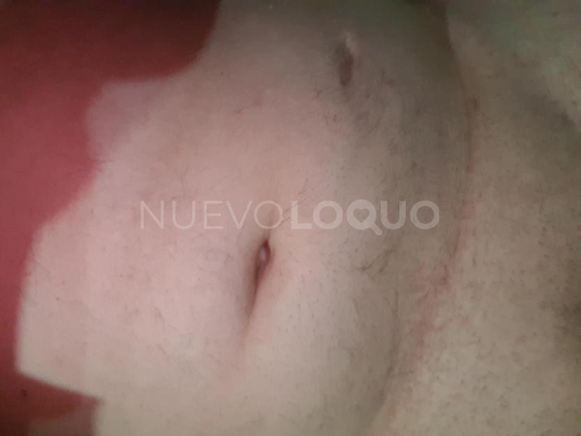 NuevoLoquo0