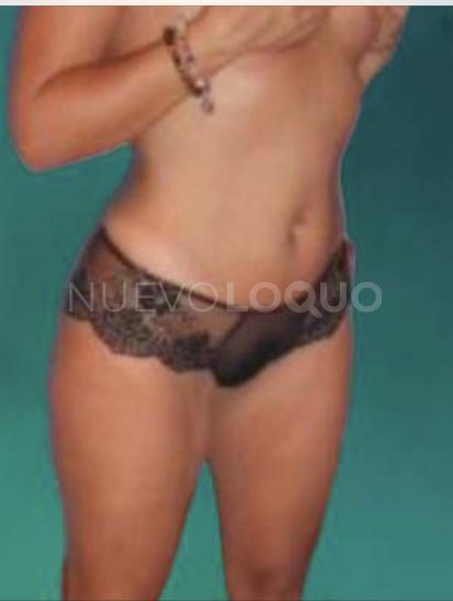NuevoLoquo1