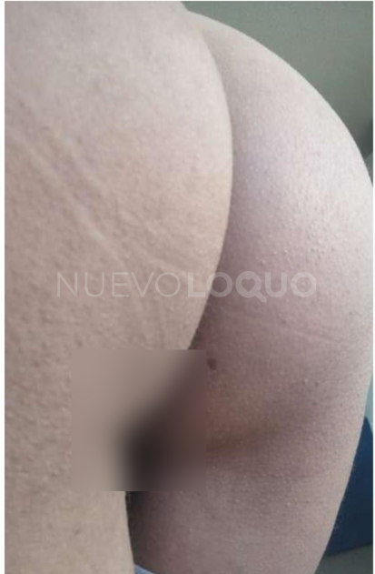 NuevoLoquo5