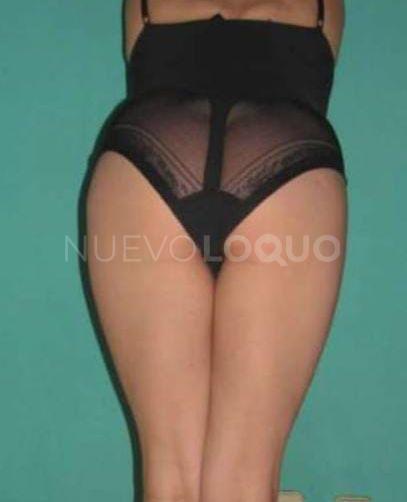 NuevoLoquo3