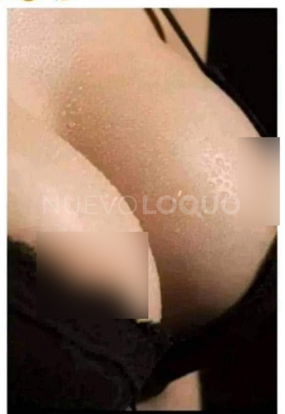 NuevoLoquo1