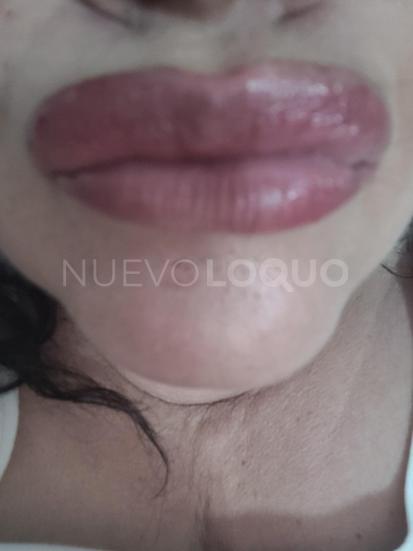NuevoLoquo3