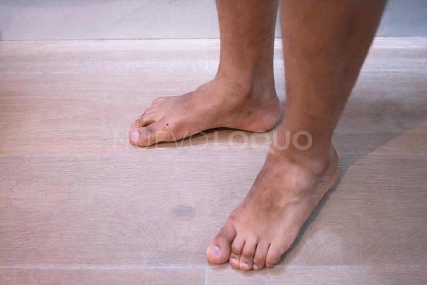 NuevoLoquo1