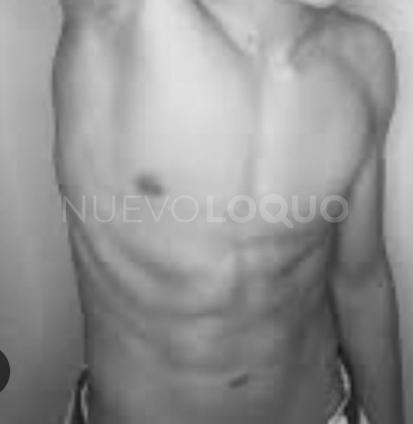 NuevoLoquo0