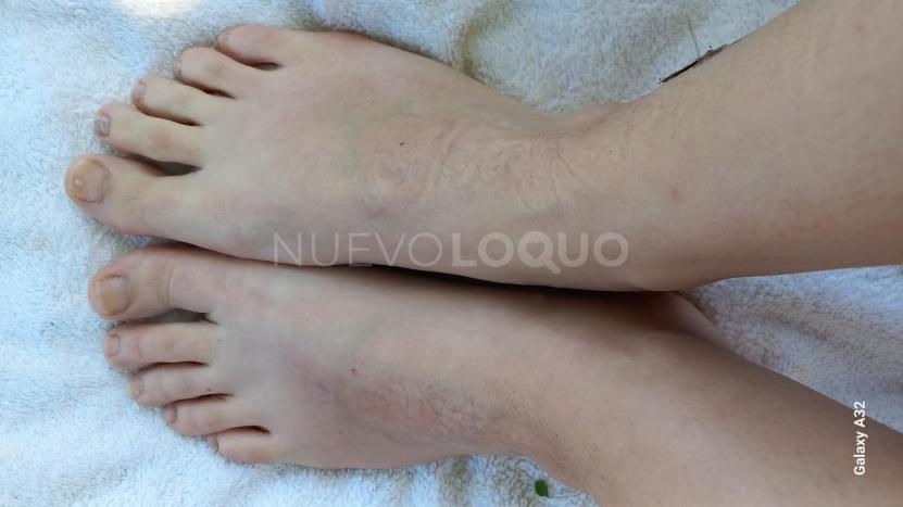 NuevoLoquo5