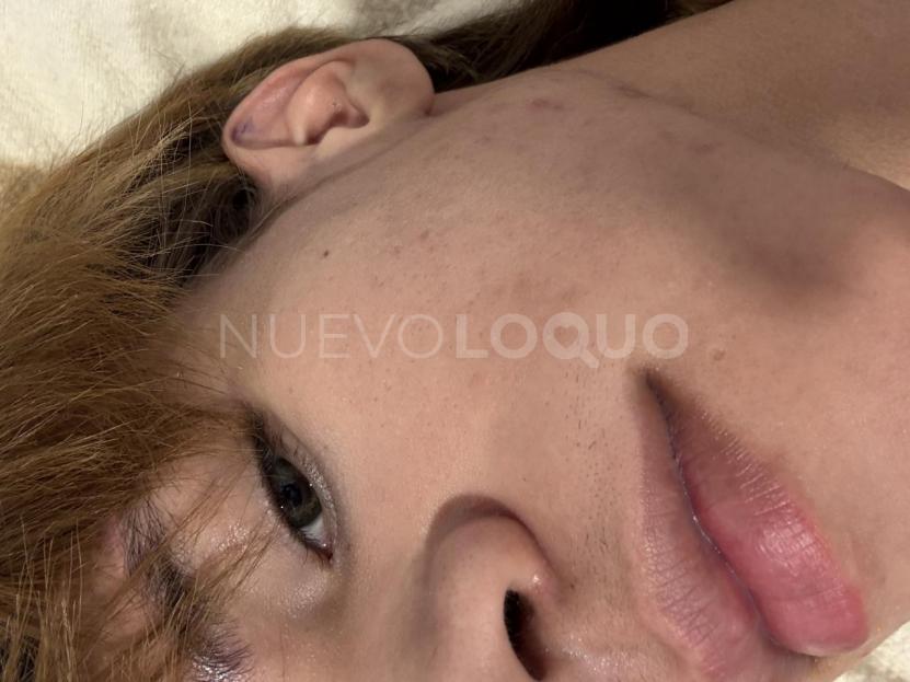NuevoLoquo4