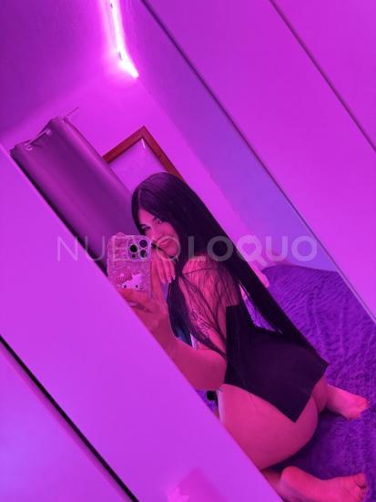  Una belleza que quema