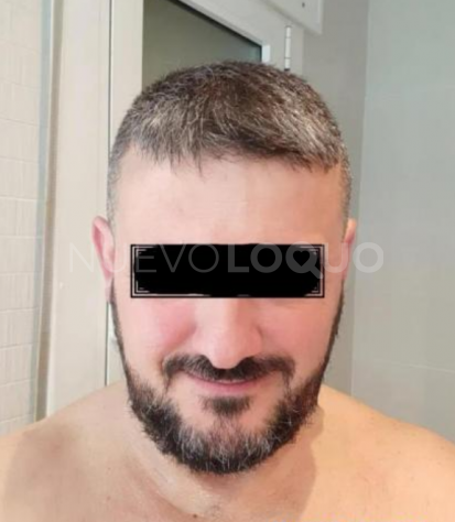 NuevoLoquo1