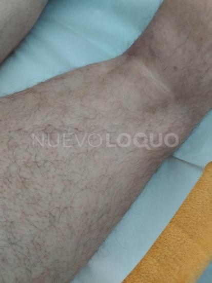 NuevoLoquo0