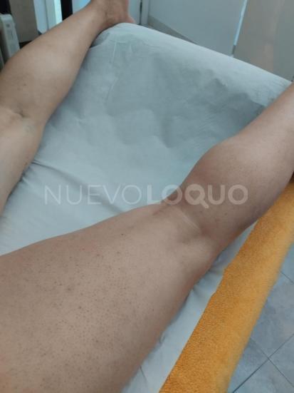 NuevoLoquo3