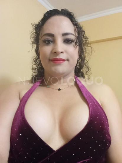  TRANS EXÓTICA MORBOSA IMPLICADA