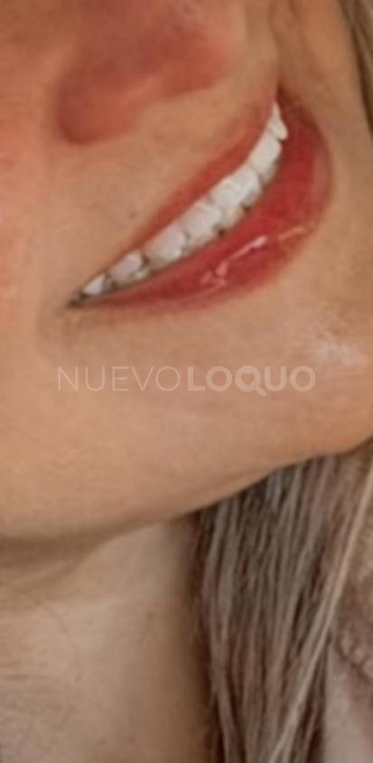 NuevoLoquo3