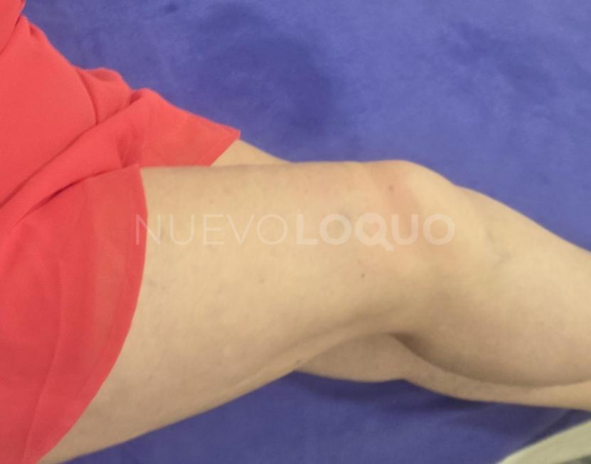 NuevoLoquo0